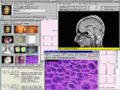 Thumbnail for version as of 00:20, 10 February 2008